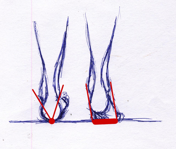 Bild 1: links: Fersenaufsatz. rechts: Vorfußaufsatz - (Füße, umgeknickt)