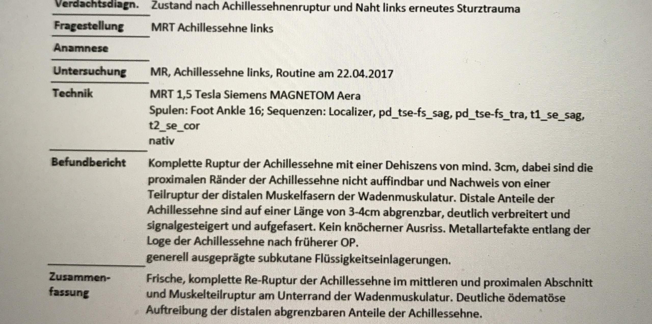 Achillessehne Gerissen Op Oder Nicht