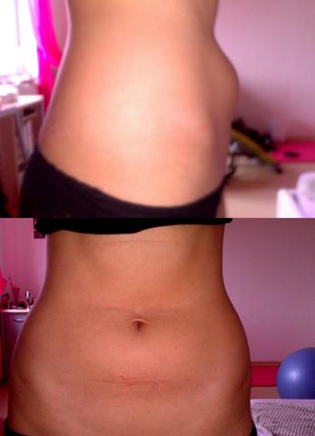 Bauch(speck) - (Fitness, abnehmen, Bauchmuskeln)