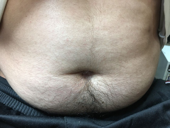 Ist mein Bauch fett oder normal?