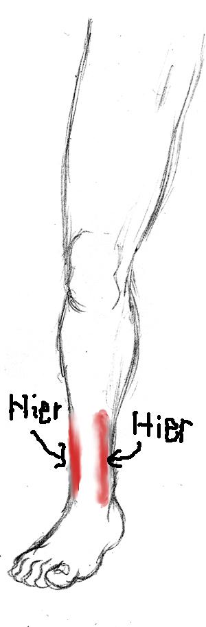 Schmerzen an den Beinen. Von was kommt es und was ist das? Was soll ich