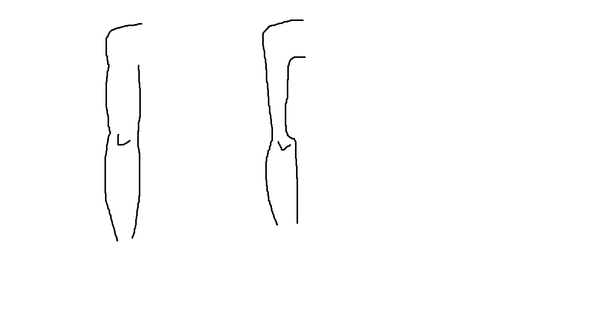 Trizeps Extrem Dunn Andert Sich Das Durch Training Muskelaufbau